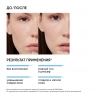 Icon Skin - Пилинг для проблемной кожи 11%, 30 мл