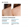 Icon Skin Acne Free Solution - Сыворотка-спрей, 100 мл