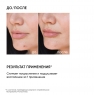 Icon Skin - Точечное SOS-средство от воспалений, 20 мл
