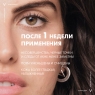 Vichy Normaderm - Лосьон очищающий, сужающий поры, 200 мл