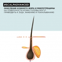 L'Oreal Professionnel - Гель-уход Scalp Advanced для чувствительной кожи головы, 200 мл - фото 6